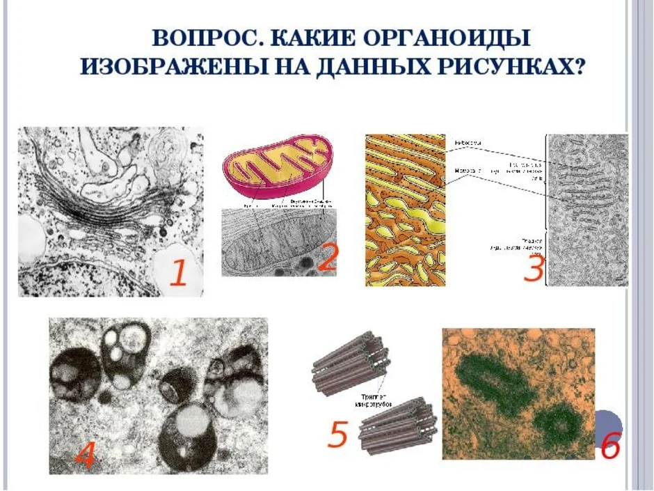 Назовите органоид изображенный на рисунке