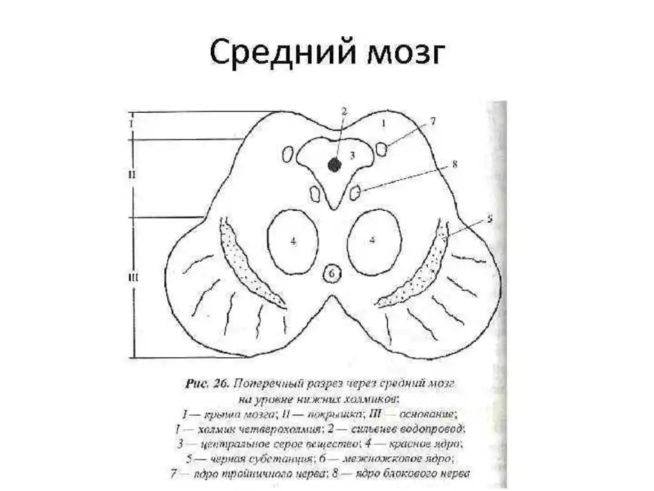 Что входит в средний мозг. Схема поперечного разреза среднего мозга. Средний мозг внутреннее строение. Срез среднего мозга схема. Схема строения среднего мозга на поперечном разрезе.