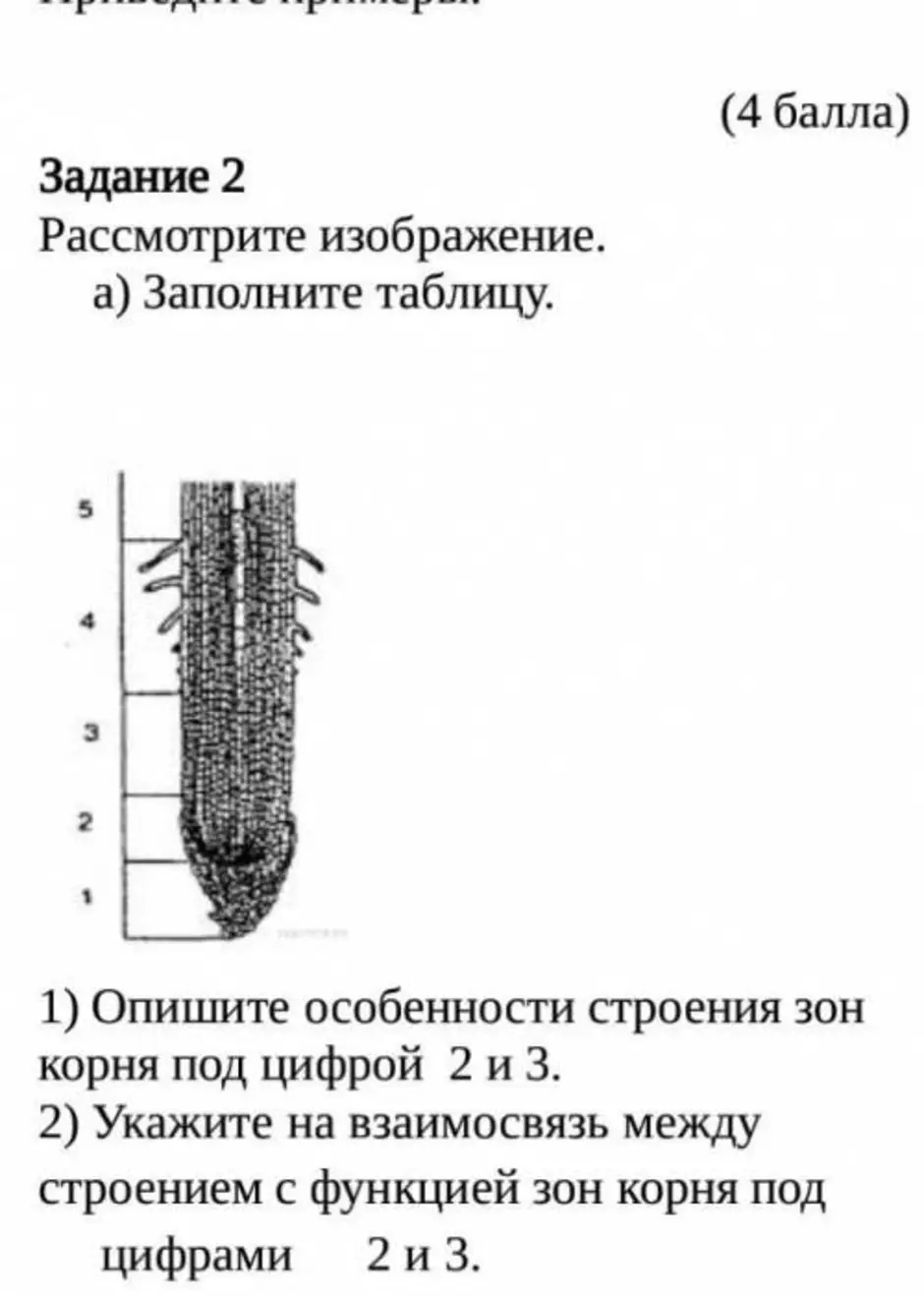 Какие зоны корня обозначены на рис