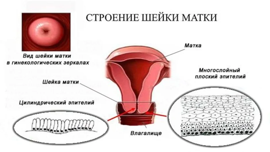 Схема шейки матки