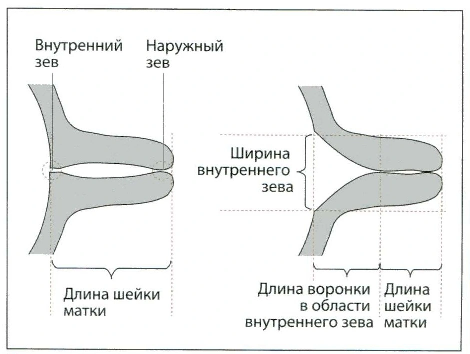 Цервикальный канал у женщин где находится и что это такое рисунок