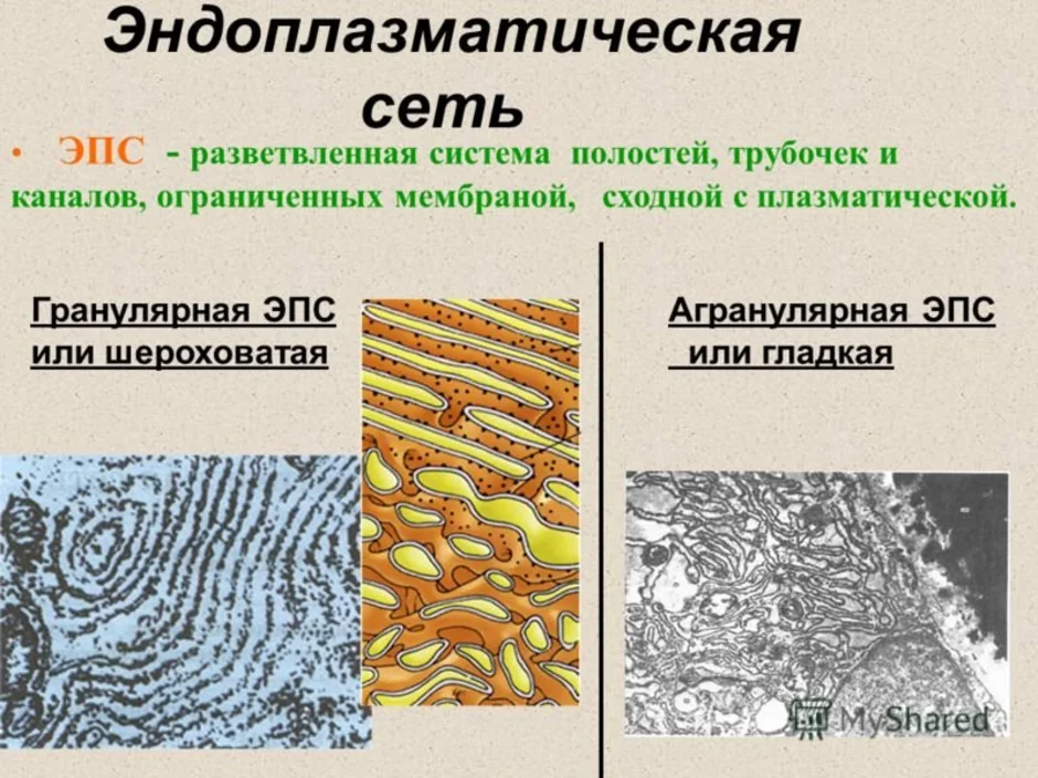 Эндоплазматическая рисунок. Эндоплазматическая сеть гранулярная и агранулярная. Агронулярная плазматическая сеть. Эндоплазматическая сеть гладкая и шероховатая.