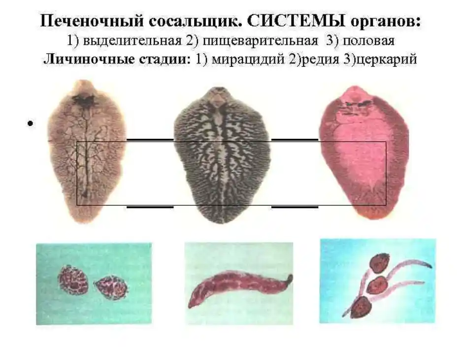 Органы печеночного сосальщика