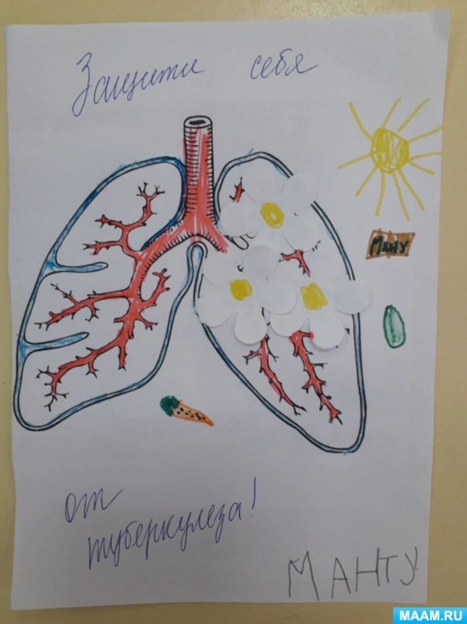 День туберкулеза в детском саду. Туберкулез рисунок. Плакат день туберкулеза. Рисунок на тему туберкулез. Плакат на тему туберкулез.