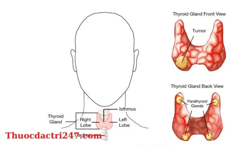 Щитовидная железа узел в левой доле. Киста щитовидной железы. Узлы и кисты щитовидной железы. Щитовидная железа рисунок. Кистозные узлы в щитовидной железе.