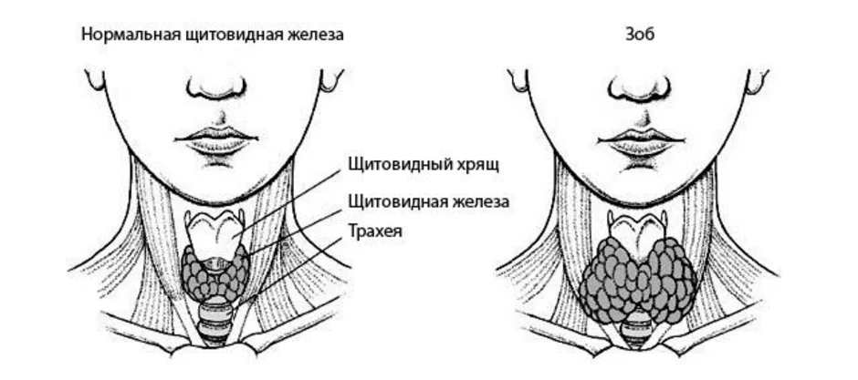 Рисунок щитовидной железы у человека