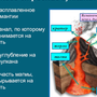 Строение вулкана рисунок