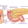 Поджелудочная железа рисунок